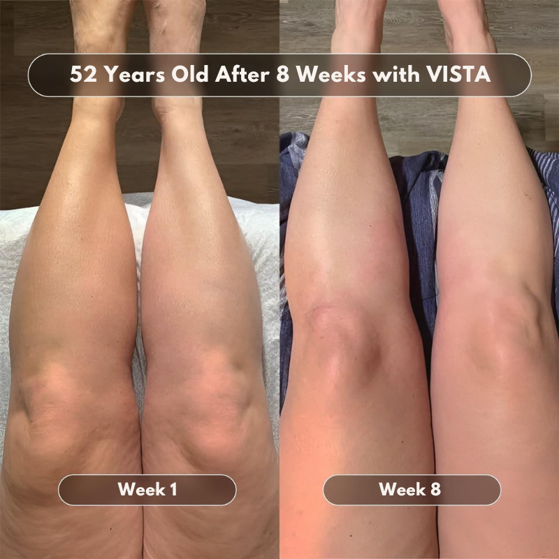 VISTA Anti-Cellulite Massage Oil